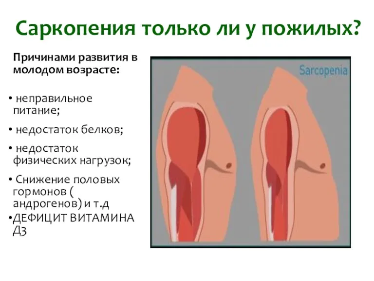 Саркопения только ли у пожилых? Причинами развития в молодом возрасте: