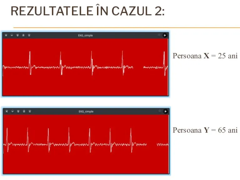 REZULTATELE ÎN CAZUL 2: Persoana X = 25 ani Persoana Y = 65 ani