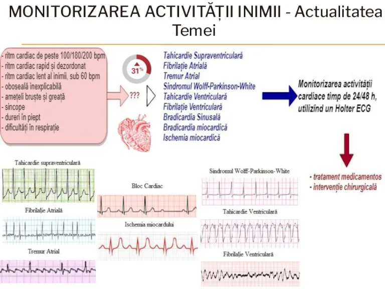 MONITORIZAREA ACTIVITĂȚII INIMII - Actualitatea Temei