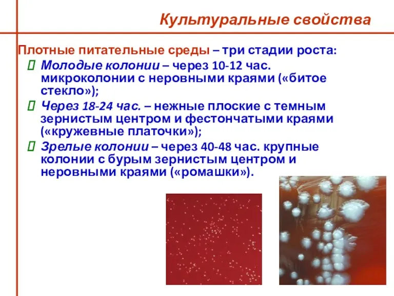 Культуральные свойства Плотные питательные среды – три стадии роста: Молодые