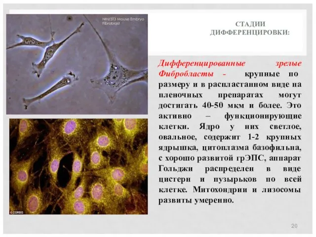 СТАДИИ ДИФФЕРЕНЦИРОВКИ: Дифференцированные зрелые Фибробласты - крупные по размеру и