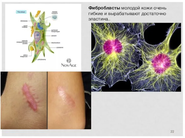 Фибробласты молодой кожи очень гибкие и вырабатывают достаточно эластина..