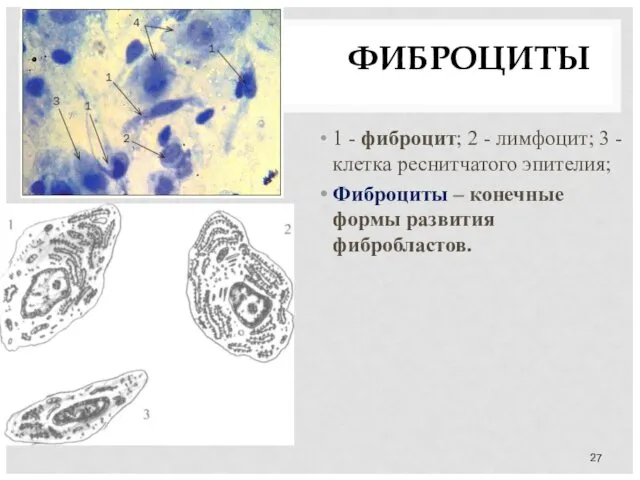 ФИБРОЦИТЫ 1 - фиброцит; 2 - лимфоцит; 3 - клетка