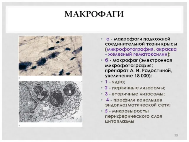 МАКРОФАГИ а - макрофаги подкожной соединительной ткани крысы (микрофотография, окраска