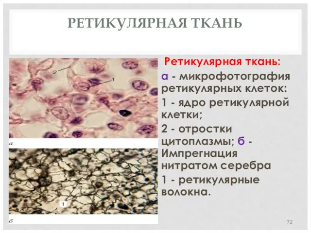 РЕТИКУЛЯРНАЯ ТКАНЬ Ретикулярная ткань: а - микрофотография ретикулярных клеток: 1