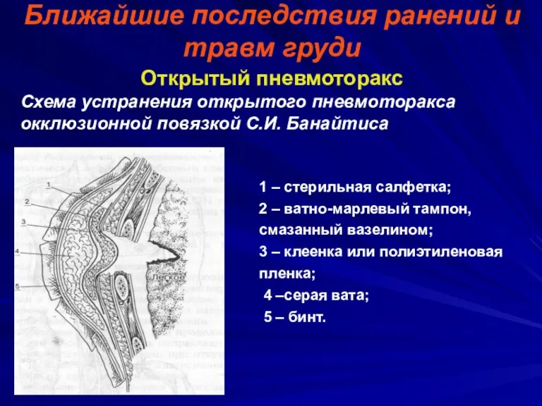 Ближайшие последствия ранений и травм груди Открытый пневмоторакс Схема устранения