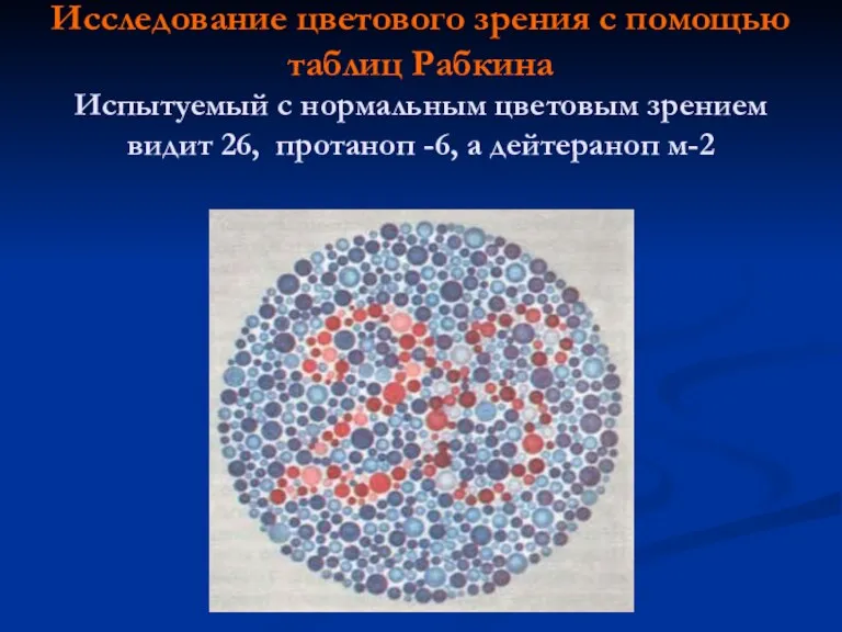 Исследование цветового зрения с помощью таблиц Рабкина Испытуемый с нормальным