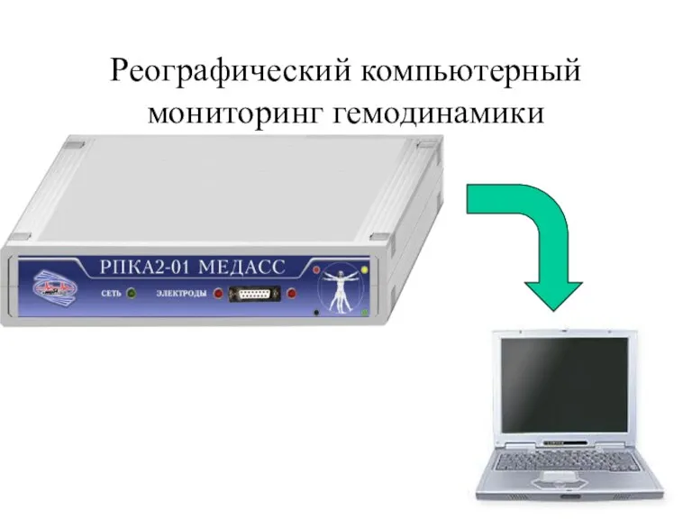 Реографический компьютерный мониторинг гемодинамики