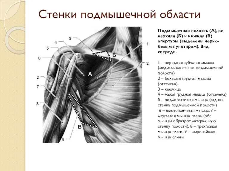 Стенки подмышечной области Подмышечная полость (А), ее верхняя (Б) и