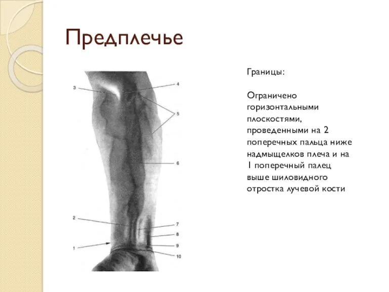 Предплечье Границы: Ограничено горизонтальными плоскостями, проведенными на 2 поперечных пальца