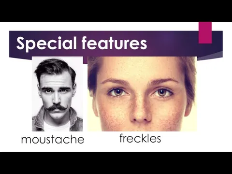 moustache freckles Special features