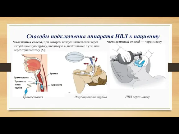 неинвазивный способ — через маску. Способы подключения аппарата ИВЛ к