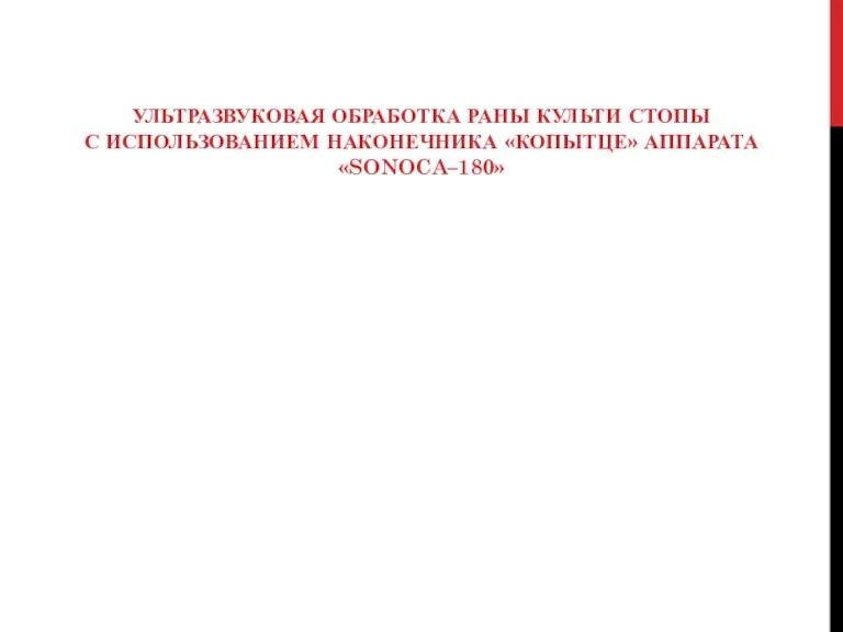 УЛЬТРАЗВУКОВАЯ ОБРАБОТКА РАНЫ КУЛЬТИ СТОПЫ С ИСПОЛЬЗОВАНИЕМ НАКОНЕЧНИКА «КОПЫТЦЕ» АППАРАТА «SONOCA–180»