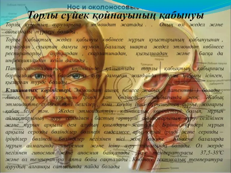 Торлы сүйек қойнауының қабынуы Торлы қуыстың ауруларына этмоидит жатады .