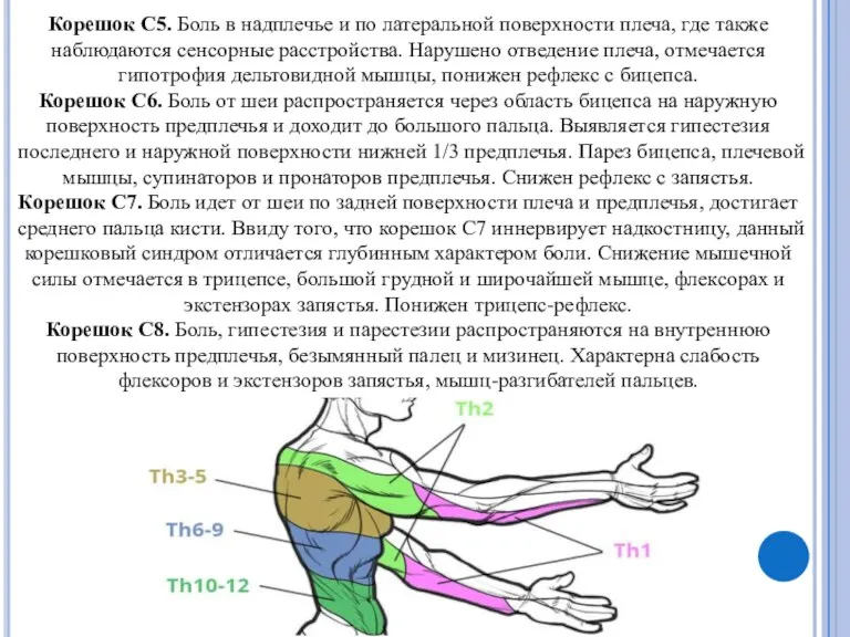 Корешок С5. Боль в надплечье и по латеральной поверхности плеча, где также наблюдаются