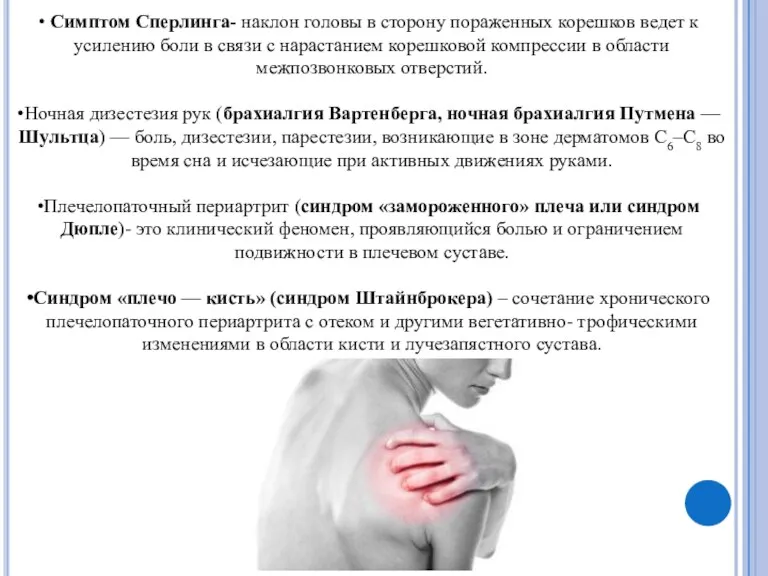 Симптом Сперлинга- наклон головы в сторону пораженных корешков ведет к