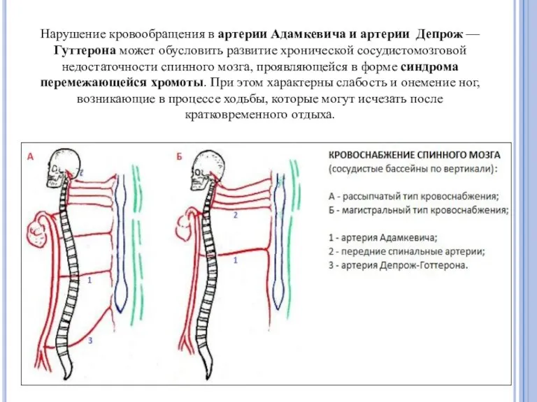 Нарушение кровообращения в артерии Адамкевича и артерии Депрож — Гуттерона может обусловить развитие