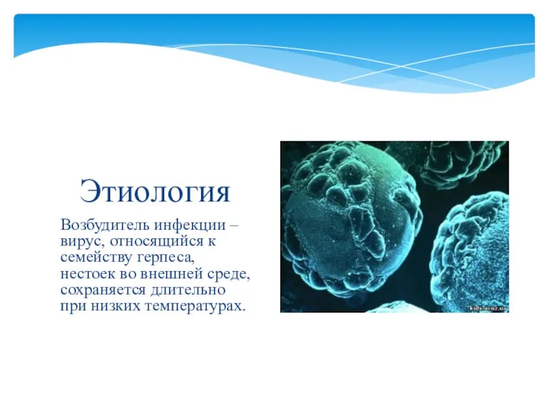 Возбудитель инфекции – вирус, относящийся к семейству герпеса, нестоек во