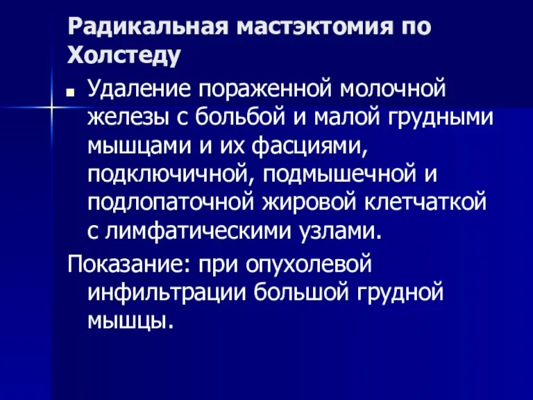 Радикальная мастэктомия по Холстеду Удаление пораженной молочной железы с больбой