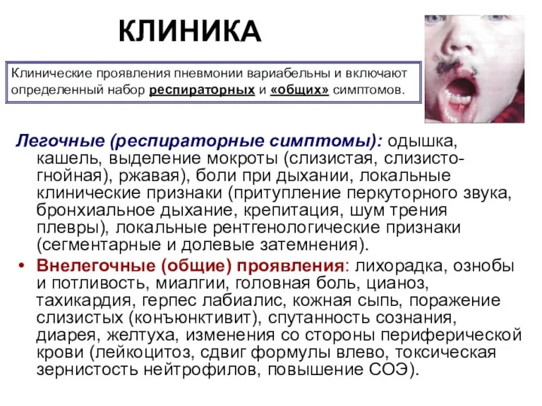 КЛИНИКА Легочные (респираторные симптомы): одышка, кашель, выделение мокроты (слизистая, слизисто-гнойная),