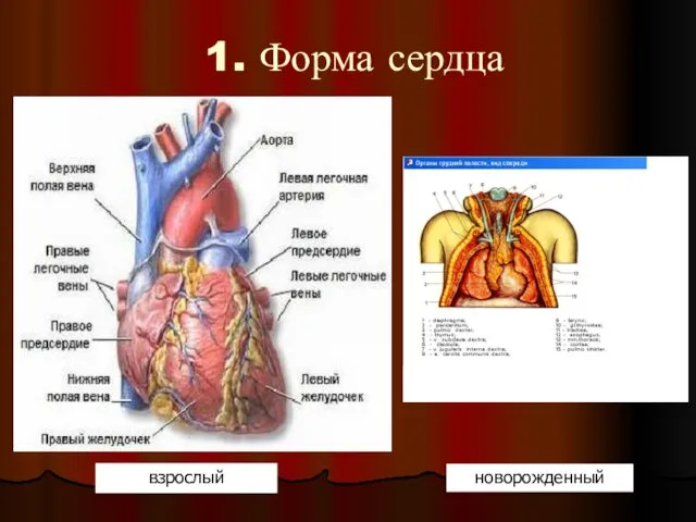 1. Форма сердца взрослый новорожденный