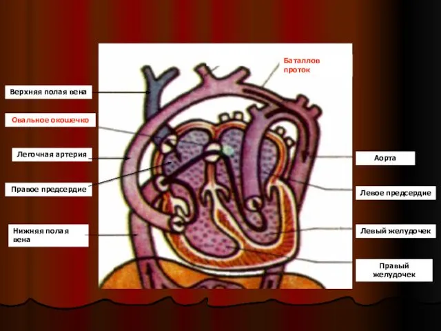 Нижняя полая вена Правое предсердие Легочная артерия Овальное окошечко Верхняя