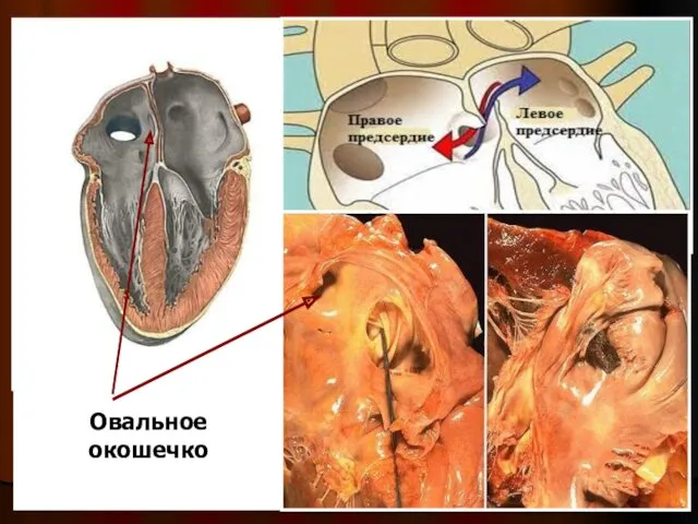 Овальное окошечко