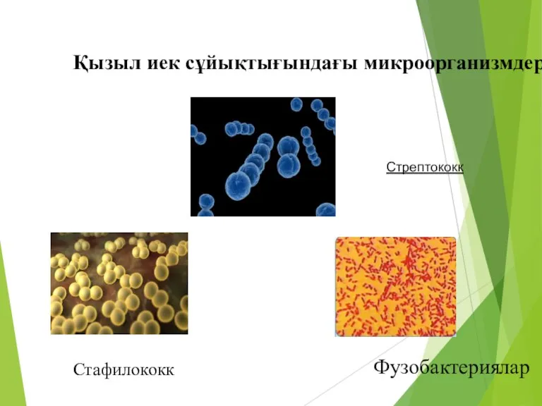 Қызыл иек сұйықтығындағы микроорганизмдер Стрептококк Стафилококк Фузобактериялар