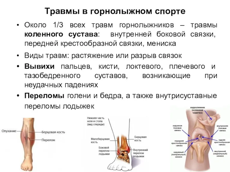 Травмы в горнолыжном спорте Около 1/3 всех травм горнолыжников –