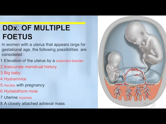 In women with a uterus that appears large for gestational age, the following