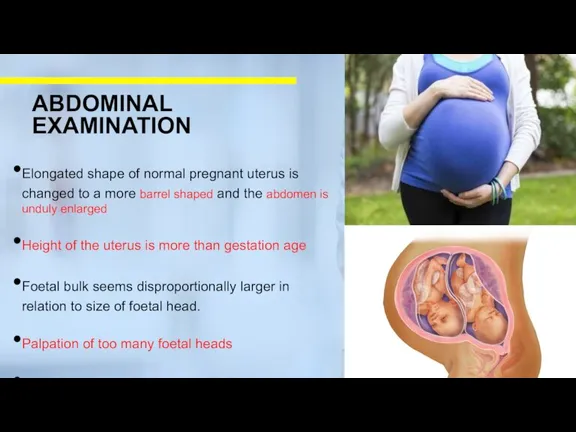Elongated shape of normal pregnant uterus is changed to a more barrel shaped