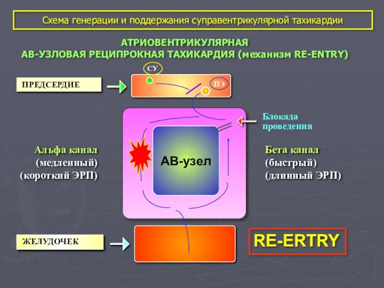 Схема генерации и поддержания суправентрикулярной тахикардии АТРИОВЕНТРИКУЛЯРНАЯ АВ-УЗЛОВАЯ РЕЦИПРОКНАЯ ТАХИКАРДИЯ