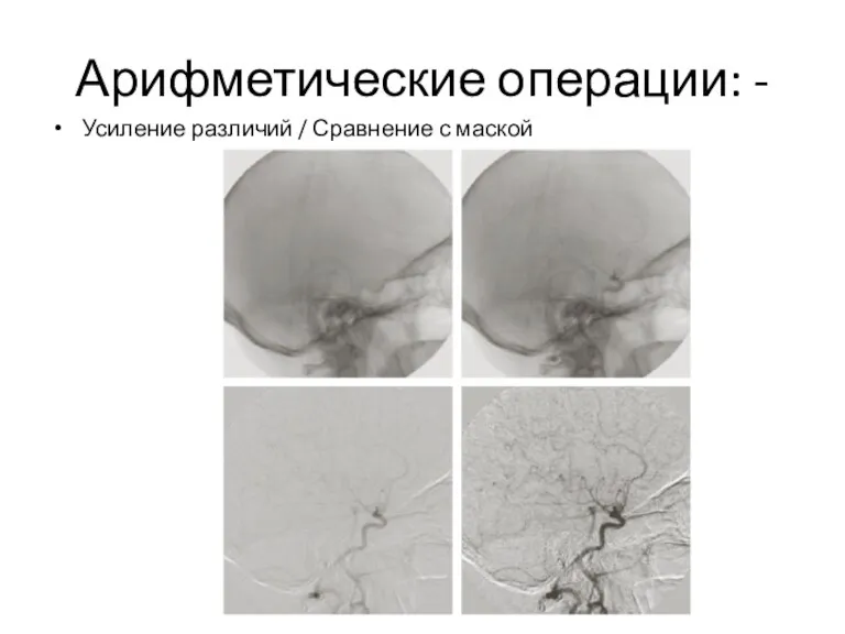 Усиление различий / Сравнение с маской Арифметические операции: -