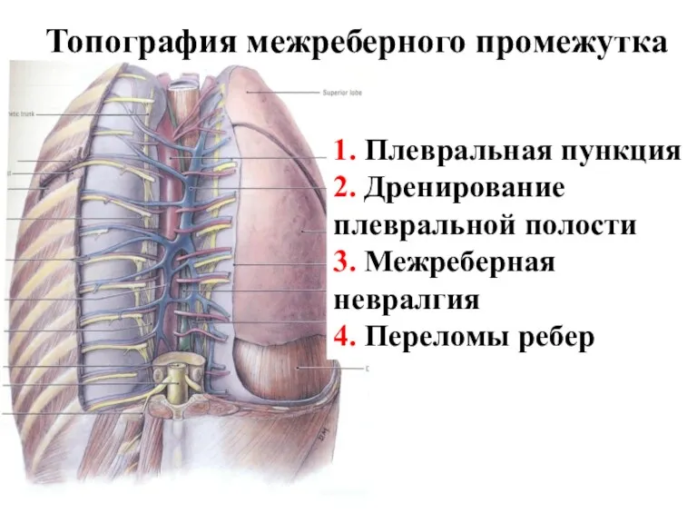 Топография межреберного промежутка 1. Плевральная пункция 2. Дренирование плевральной полости 3. Межреберная невралгия 4. Переломы ребер