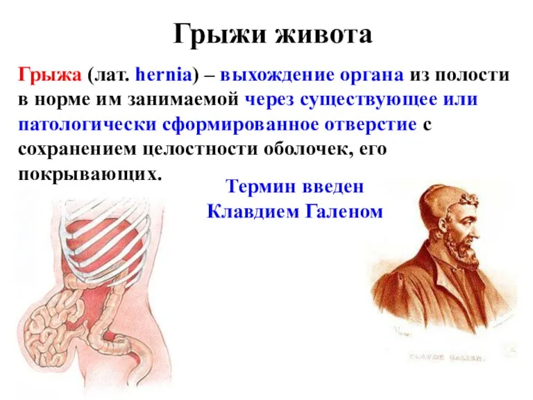 Грыжи живота Грыжа (лат. hernia) – выхождение органа из полости