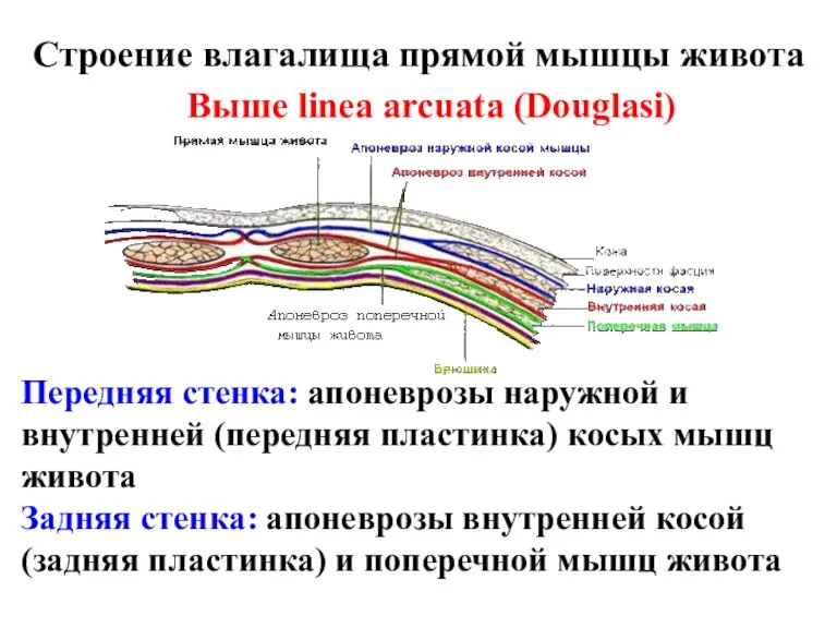 Строение влагалища прямой мышцы живота Выше linea arcuata (Douglasi) Передняя