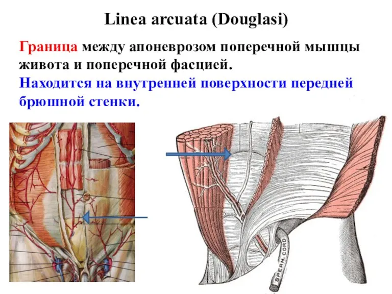 Linea arcuata (Douglasi) Граница между апоневрозом поперечной мышцы живота и