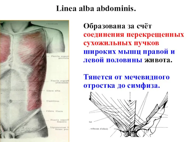 Linea alba abdominis. Образована за счёт соединения перекрещенных сухожильных пучков