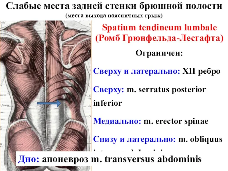 Spatium tendineum lumbale (Ромб Грюнфельда-Лесгафта) Ограничен: Сверху и латерально: XII