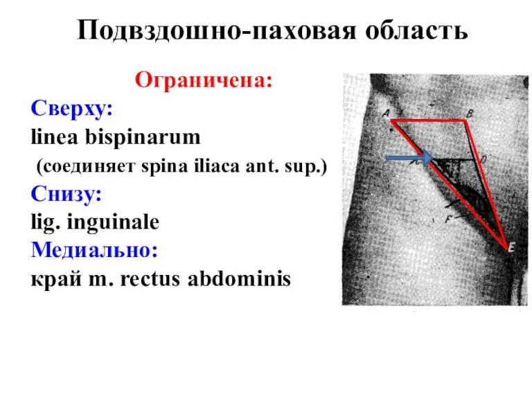 Подвздошно-паховая область Ограничена: Сверху: linea bispinarum (соединяет spina iliaca ant.