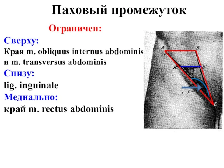 Ограничен: Сверху: Края m. obliquus internus abdominis и m. transversus