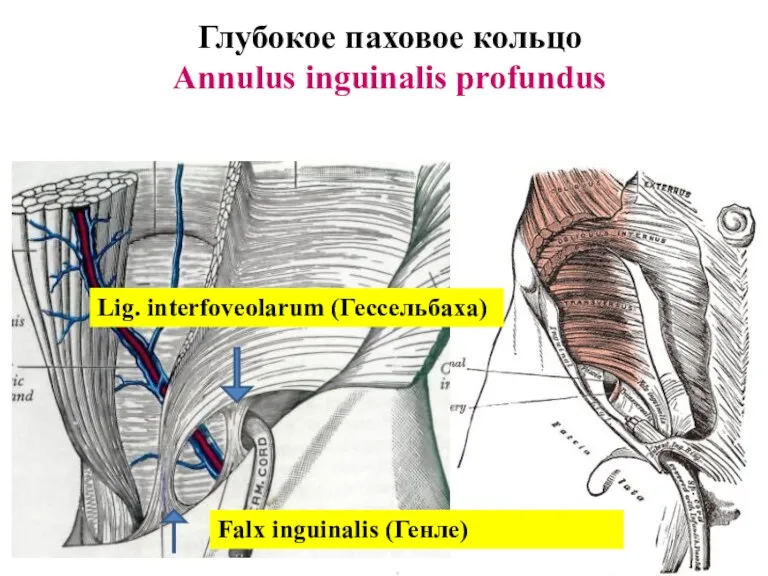 Глубокое паховое кольцо Annulus inguinalis profundus Lig. interfoveolarum (Гессельбаха) Falx inguinalis (Генле)