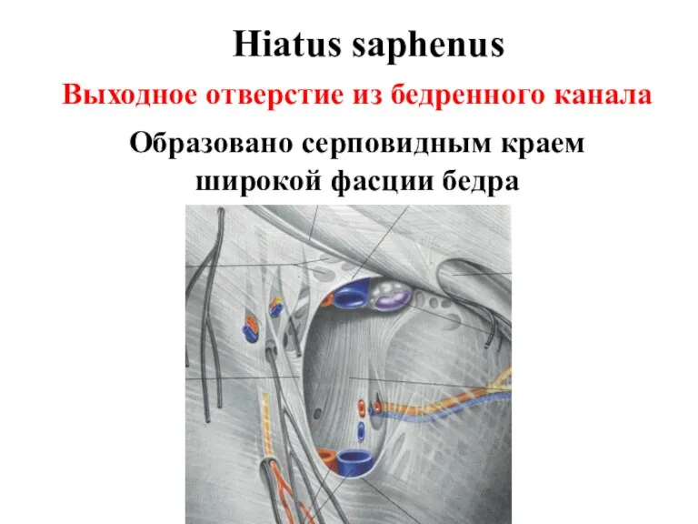 Hiatus saphenus Выходное отверстие из бедренного канала Образовано серповидным краем широкой фасции бедра