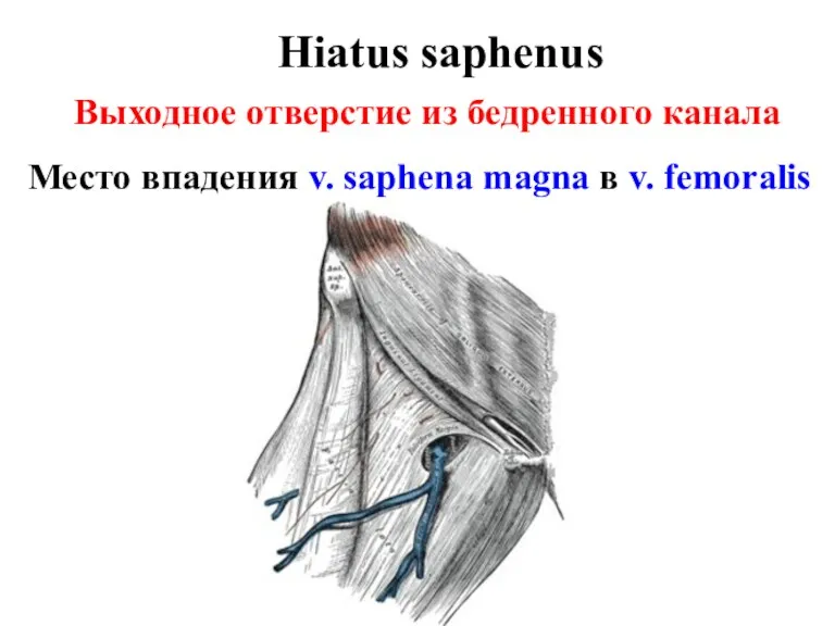 Hiatus saphenus Выходное отверстие из бедренного канала Место впадения v. saphena magna в v. femoralis