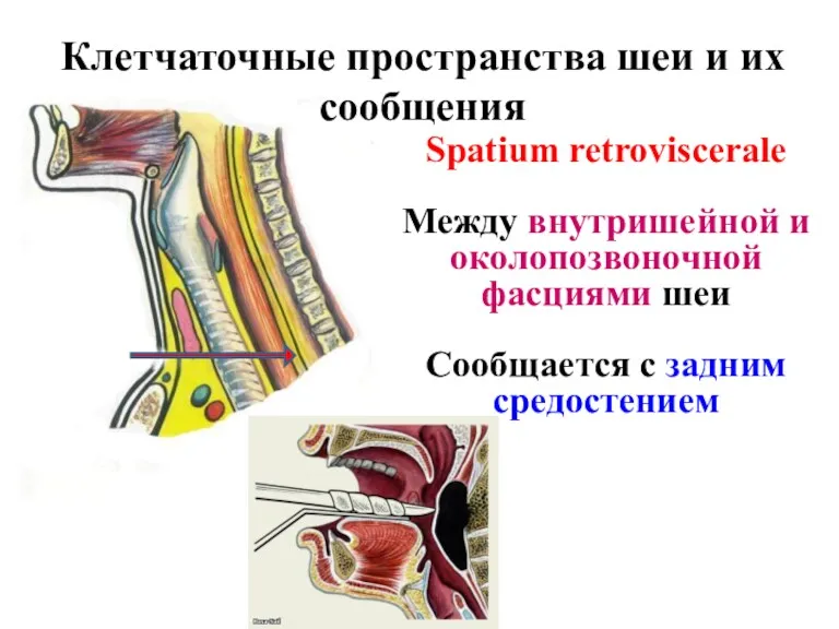 Клетчаточные пространства шеи и их сообщения Spatium retroviscerale Между внутришейной