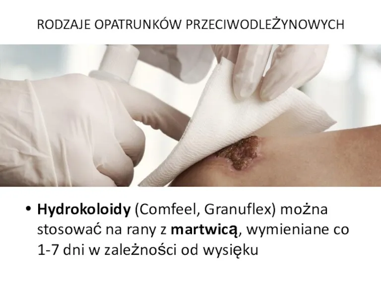 Hydrokoloidy (Comfeel, Granuflex) można stosować na rany z martwicą, wymieniane co 1-7 dni