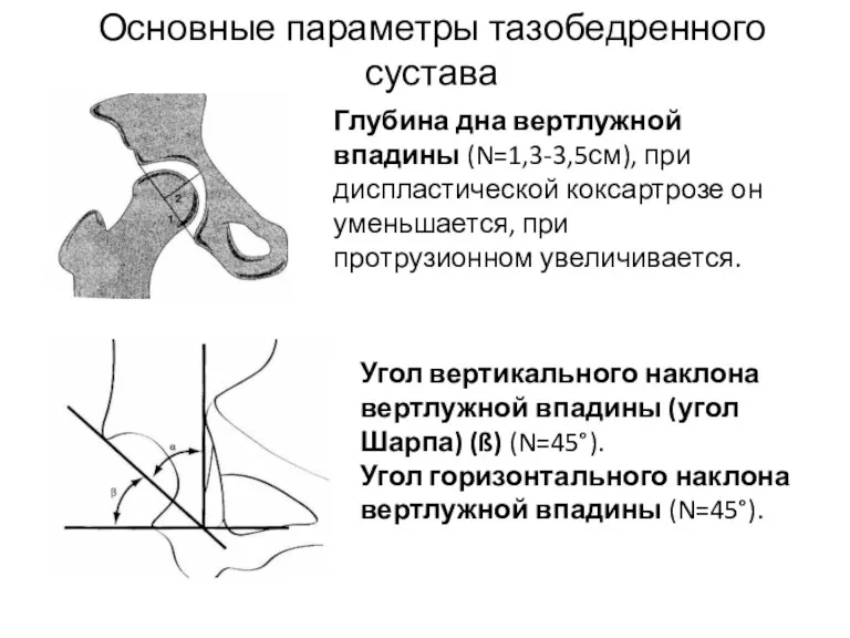 Основные параметры тазобедренного сустава Глубина дна вертлужной впадины (N=1,3-3,5см), при