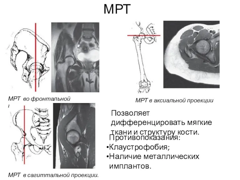 МРТ во фронтальной проекции. МРТ в аксиальной проекции МРТ МРТ в сагиттальной проекции.