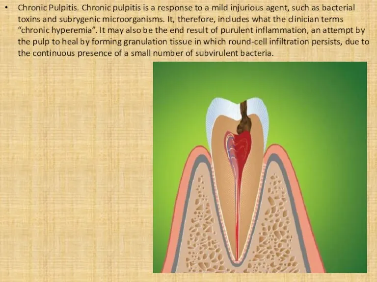 Chronic Pulpitis. Chronic pulpitis is a response to a mild injurious agent, such