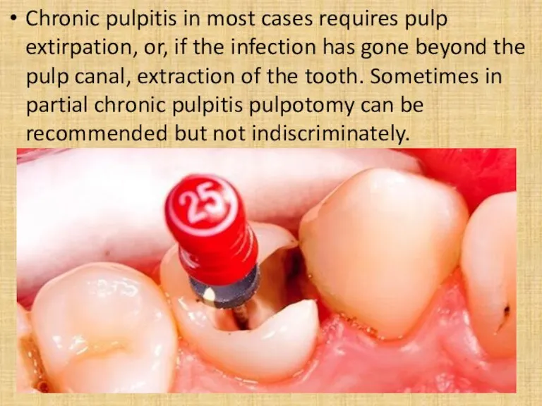 Chronic pulpitis in most cases requires pulp extirpation, or, if the infection has